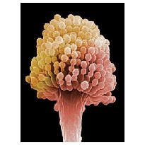 Micotoxinas