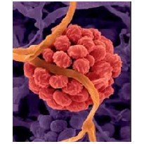 Micotoxinas