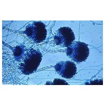 Micotoxinas
